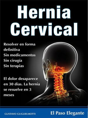 cover image of Hernia cervical